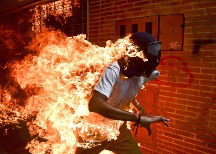 Foto: Venezuela Crisis / Fotógrafo: Ronaldo Schemidt